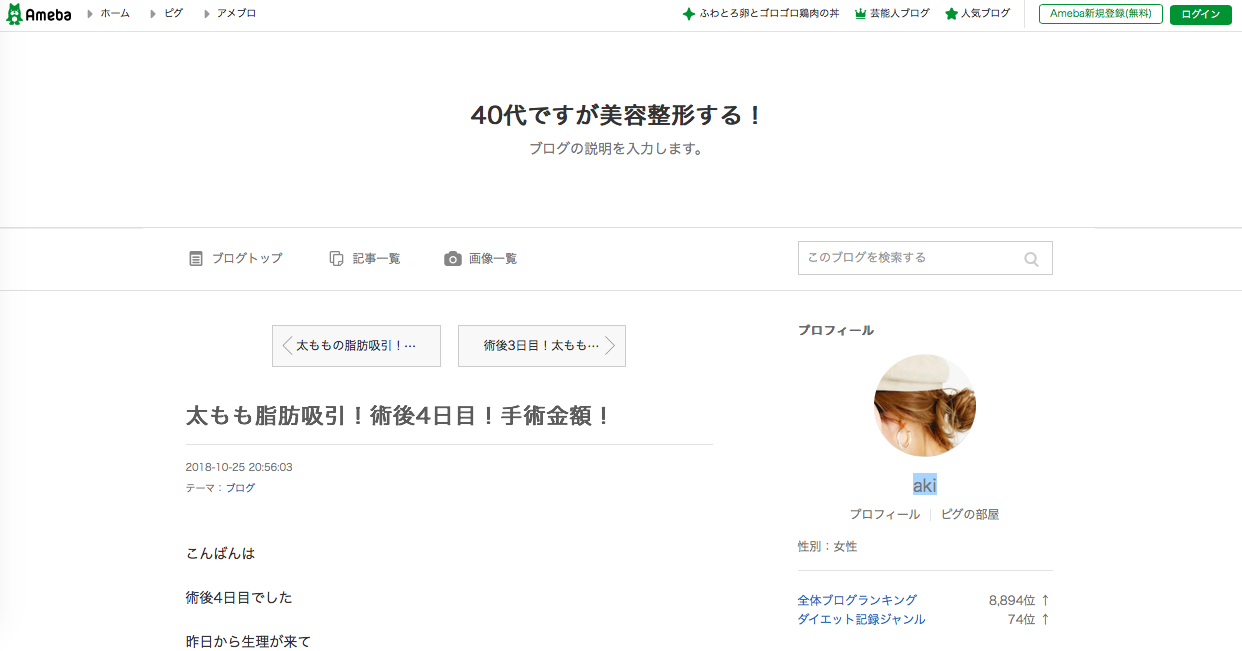 40代ですが美容整形する!のキャプチャ
